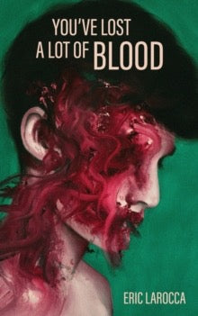 You've Lost A Lot Of Blood